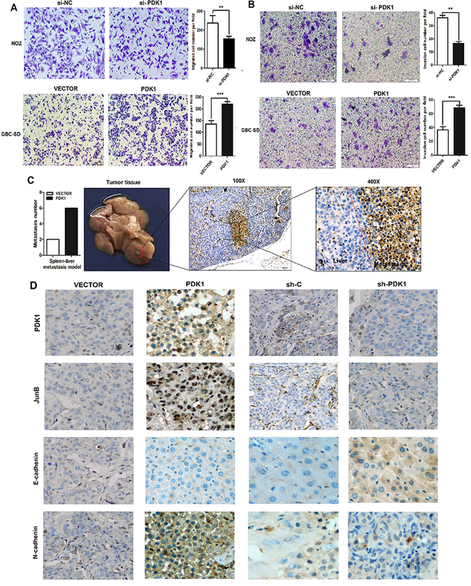 PDK1 promotes GBC cell invasion and metastasis both in vitro and in vivo.