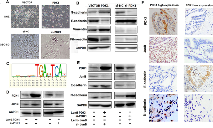 PDK1 induces JunB, which increases EMT in GBC.