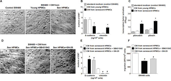Effect of senescent HPMCs on the development of EMT in SW480 cells.