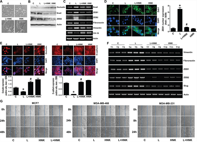 Honokiol inhibits leptin-induced epithelial-mesenchymal transition and migration of breast cancer cells.