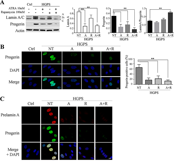 Progerin and prelamin A protein amount after 28 days of treatment.