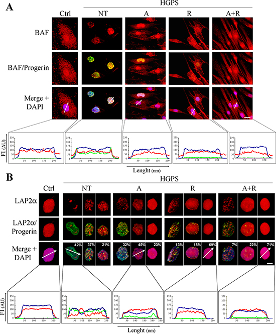 Analysis of chromatin and lamin-associated functional platforms after 28 days of treatment.