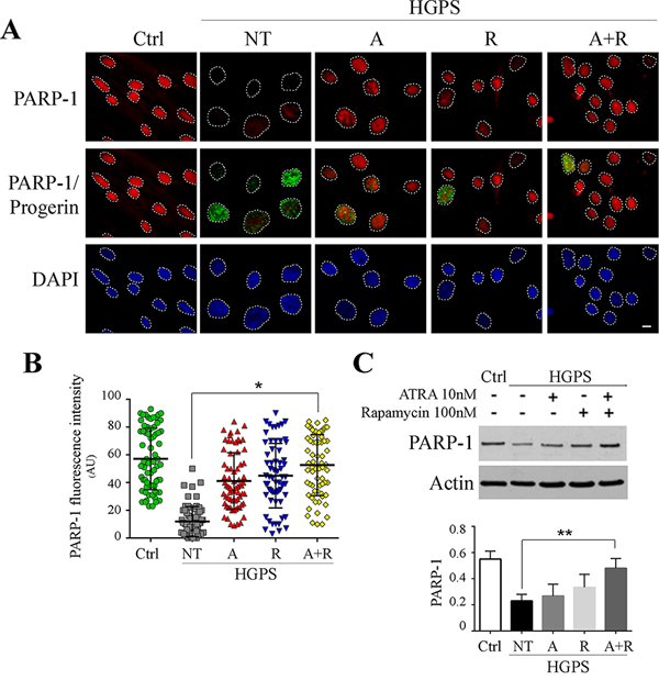 PARP-1 recovery following 28 days treatments administration.