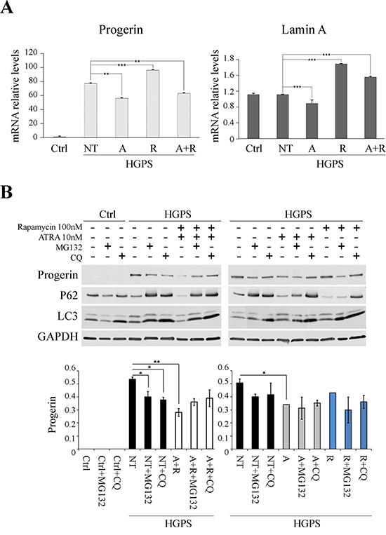 Effect of treatments on LMNA gene expression and on involvement of protein degradation pathways as the putative mechanisms of progerin reduction.