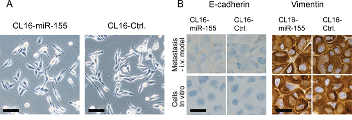 No difference in morphology, E-cadherin or vimentin expression was observed between CL16-miR-155 and CL16-Ctrl cells.