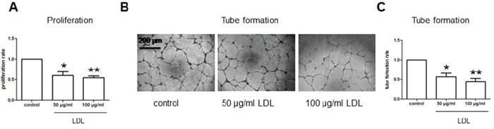 LDL attenuates cell proliferation and tube formation of hCMEC/D3 cells under hypoxic condition.