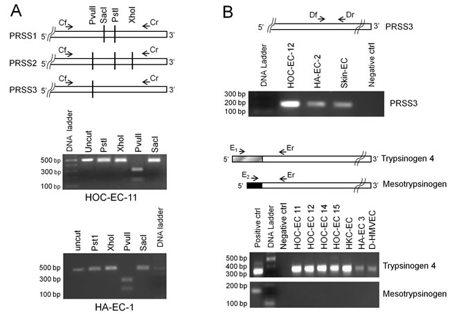 Trypsin expression by endothelial cells.