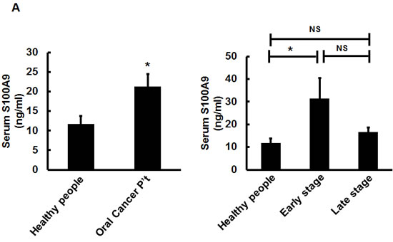 Extracellular S100A9 protein promoted oral cancer migration and invasion, monocytic U937 transendothelial migration, and angiogenesis.