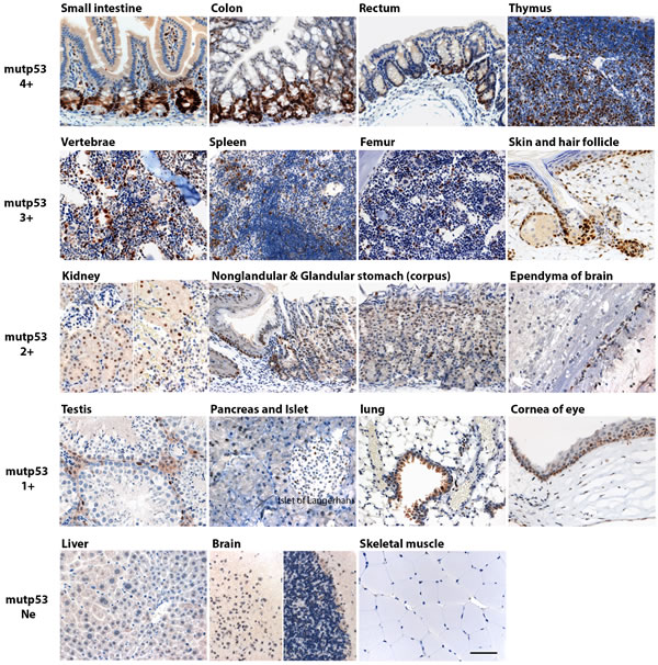 Mutp53 accumulation in morphologically normal multiple tissues in p53 R172H mice.