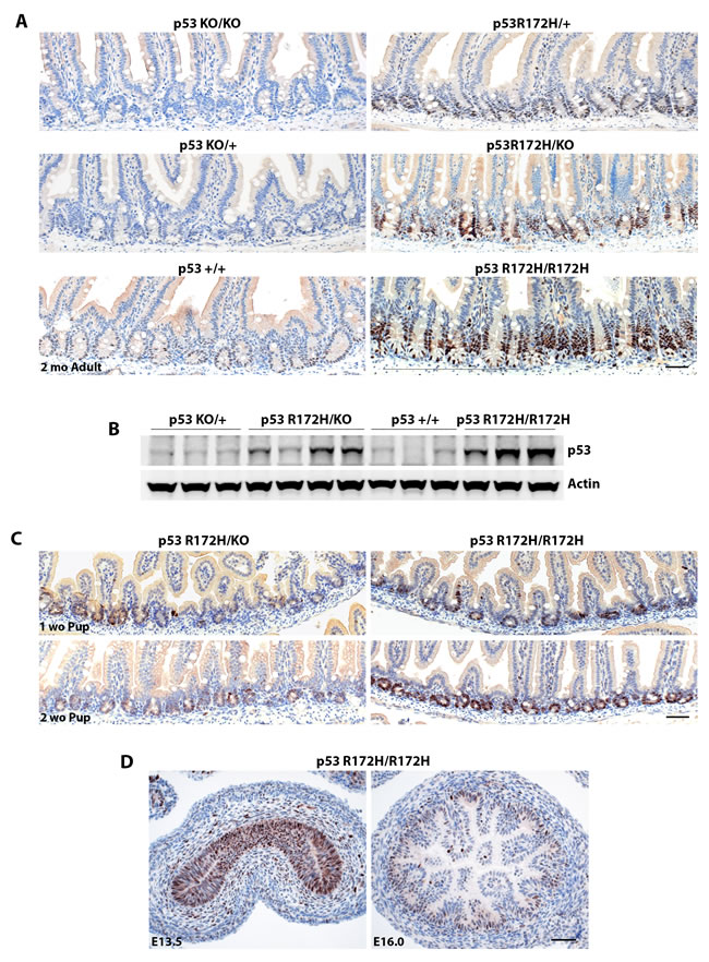 p53 R172H protein accumulation is dosage dependent and cell type specific.