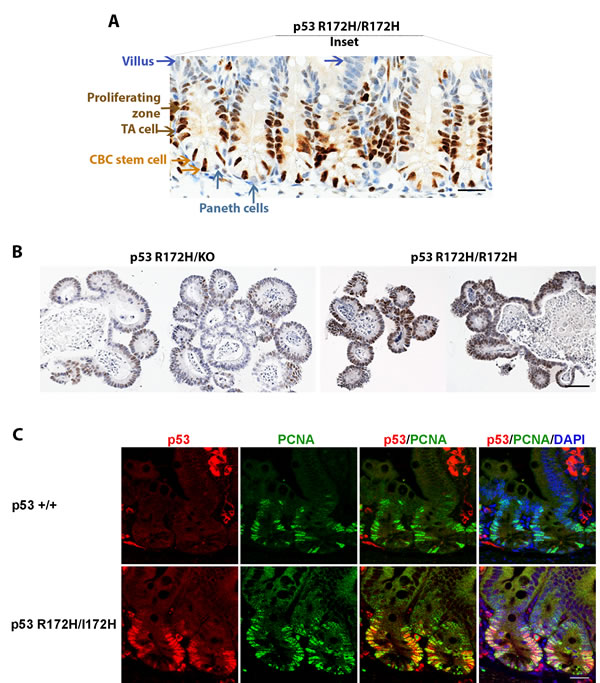 p53 R172H expression in cycling and proliferative cells of small intestinal crypts.