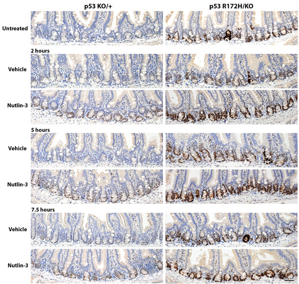 Time course of p53 protein accumulation after nutlin treatment.