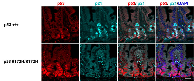 p21 protein accumulation in p53 wild type but not in p53 R172H mouse small intestines after 8 Gy irridiation.