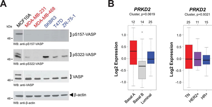 Expression and phosphorylation status of VASP and PKD2.