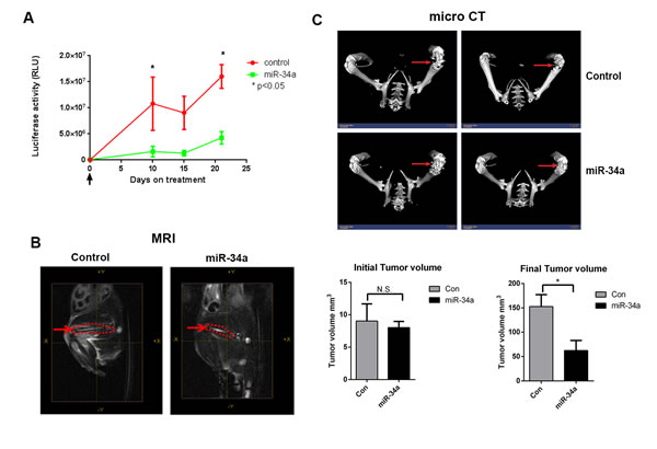 Systemic miR-34a delivery by chitosan nanoparticles decreases prostate tumor growth in bone in an intra-femoral model.