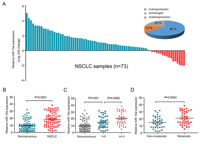 MiR-10a is overexpressed in NSCLC and correlated with clinical stage and tumor metastasis.