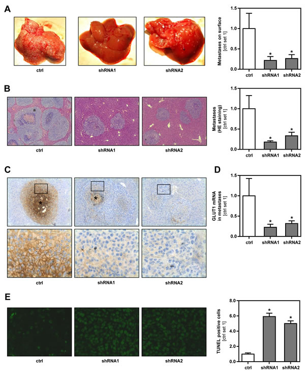 Effect of GLUT1 inhibition on hepatic metastasis of B16 melanoma cells