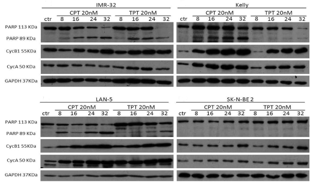 Effects of camptothecin (CPT) and topotecan (TPT) on cell cycle proteins and PARP cleavage.