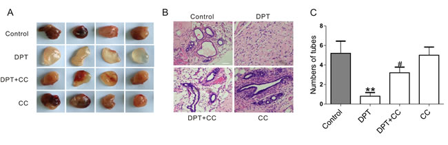 DPT-mediated anti-angiogenesis effect in Matrigel plug assay through AMPK activation.