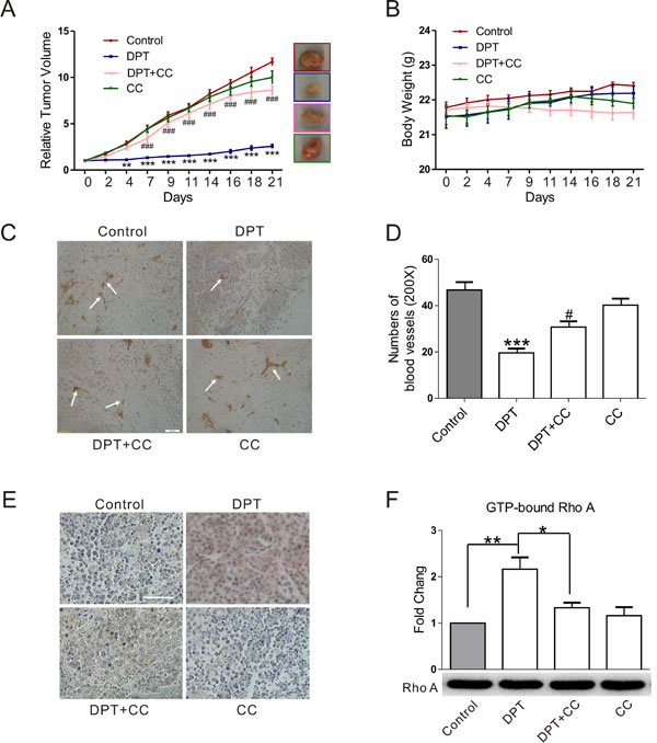 DPT-mediated anti-tumor and anti-angiogenesis effect in the xenograft mouse model.
