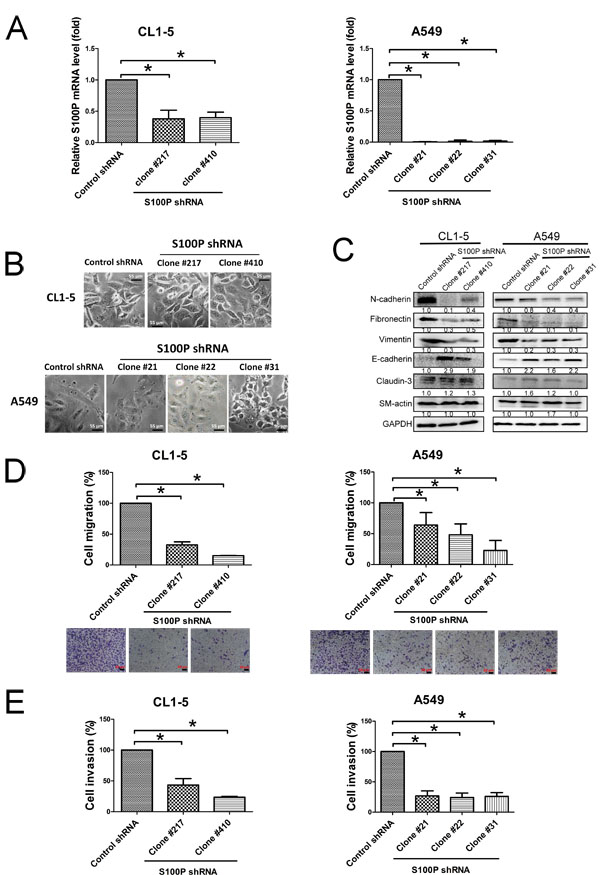 Loss of S100P protein caused MET and decreased cell migration and invasion in lung cancer cells.