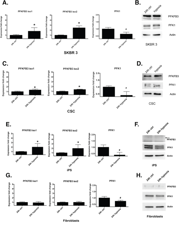 Regulation of PFKFB3 and PFK1 by hypoxia.