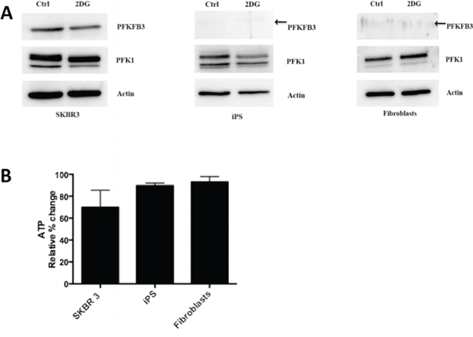 Inhibition of glycolysis by 2-DG.