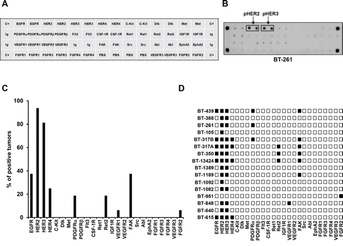Expression of activated forms of different tyrosine kinases (TKs) in tumor samples from patients with ovarian cancer.