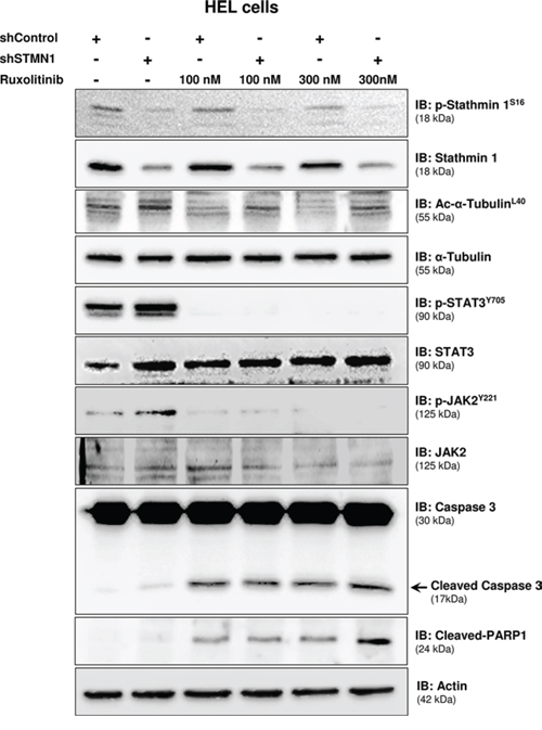 Stathmin 1 silencing prevents microtubule instability induced by ruxolitinib treatment.