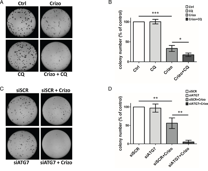Effect of ALK oncogene inhibition combined with pharmacological or molecular inhibition of the autophagy machinery on Karpas-299 clonogenic survival.