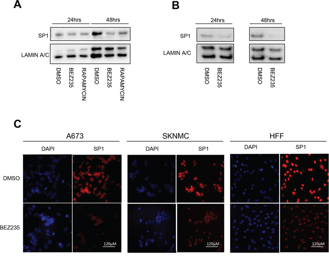 BEZ235 treatment affects SP1 levels.