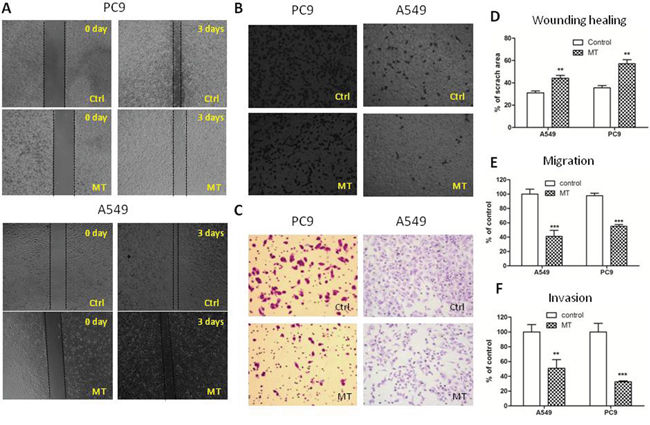 M2R antagonist methoctramine suppresses the migration and invasion of NSCLC cells.