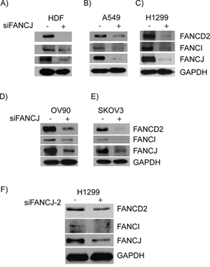 Down-regulation or loss of FANCJ concomitantly diminishes FANCD2 and FANCI proteins in multiple cell lines.
