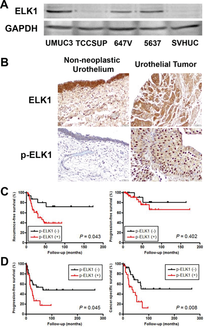 ELK1 expression in bladder cancer.