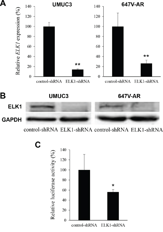 Silencing of ELK1 in bladder cancer cells.