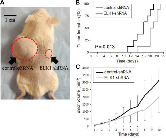 Effects of ELK1 inactivation on tumor growth in mouse xenograft models for bladder cancer.