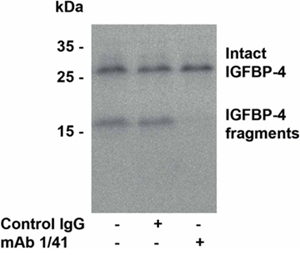 Immunoblotting of IGFBP-4.