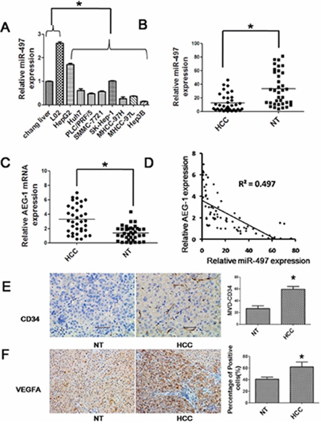 Reduced expression of miR-497 in liver cancer cell lines and tissues.