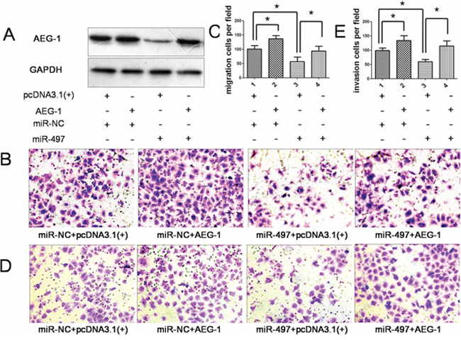 Overexpression of AEG-1 attenuated the anti-metastatic effect of miR-497.