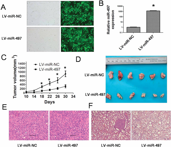 miR-497 impairs the growth of hepatoma xenografts and suppresses metastasis in vivo.