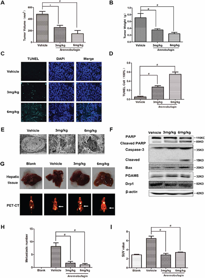 Arenobufagin inhibits growth and metastasis of orthotopically implanted colorectal carcinoma through inducing apoptosis.