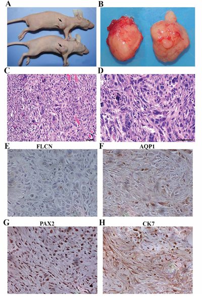 Flcn-deficient renal distal tubule cells are tumorigenic.
