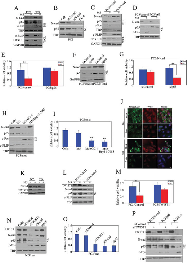 Pro-apoptotic effect of metformin is TWIST1/N-cadherin/NF-kappaB signaling dependent.