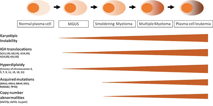 Schematic representation of MM progression and oncogenic events along the four clinical phases: MGUS, SMM, MM, PCL. See details in the text.