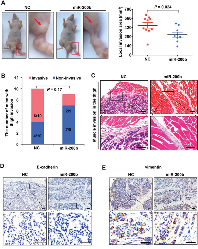 miR-200b suppresses ESCC tumor invasion in vivo.