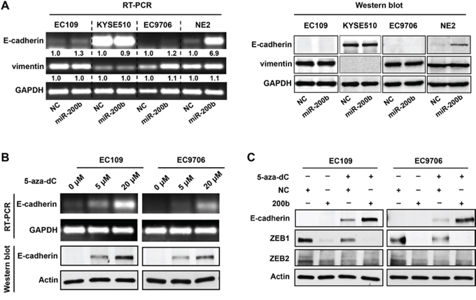 DNA methylation of E-cadherin gene blocks the control of E-cadherin expression by the miR-200b-ZEB1/2 axis.