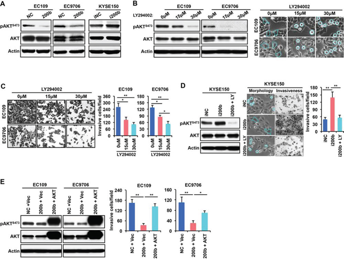 AKT mediates the biological effect of miR-200b in suppressing ESCC cell invasiveness.
