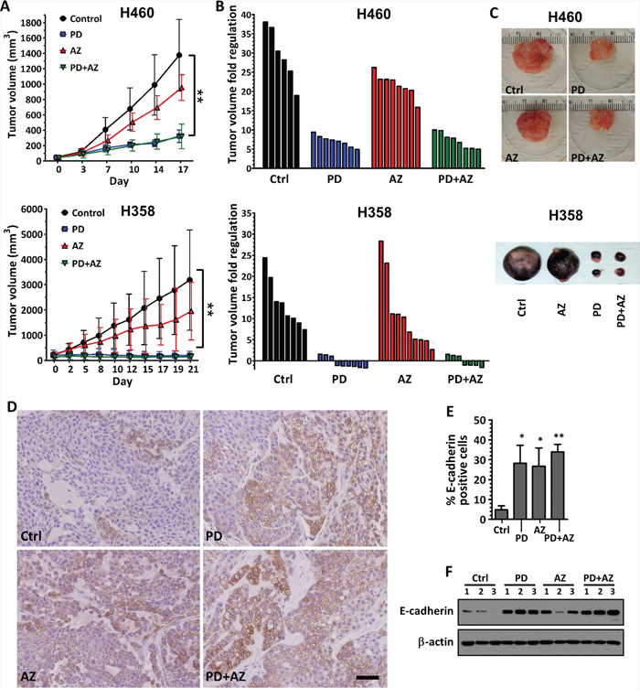 Inhibition of tumor growth and induction of E-cadherin expression in xenograft tumors by PD0325901 or Saracatinib treatment alone or in combination.