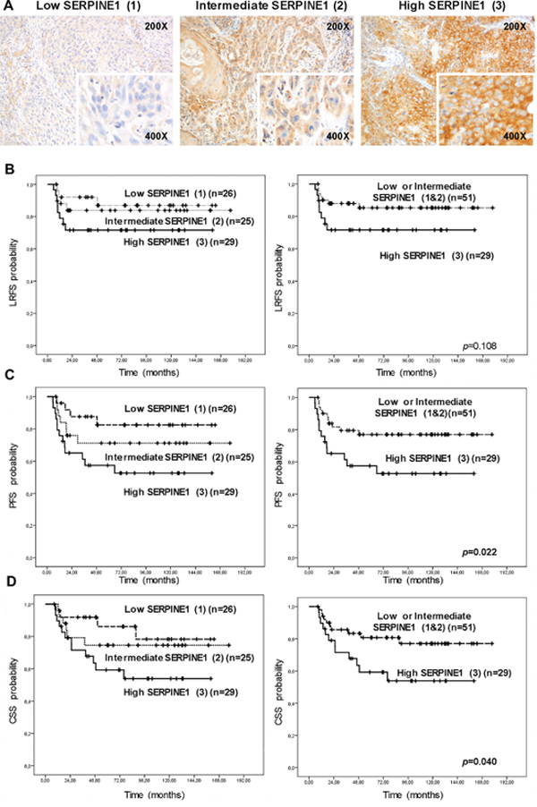 High protein SERPINE1 expression is associated with poor prognosis in patients with head and neck carcinoma included in a retrospective study.