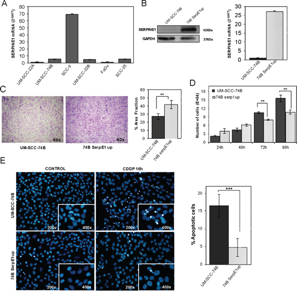 Ectopic over-expression of SERPINE1 increases migration, reduces proliferation and inhibits apoptotic induction in the UM-SCC-74B HNSCC cell line.